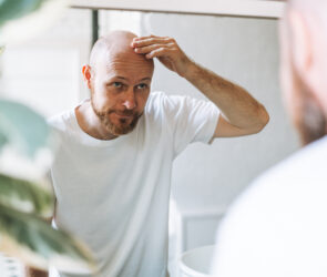 caduta capelli uomo